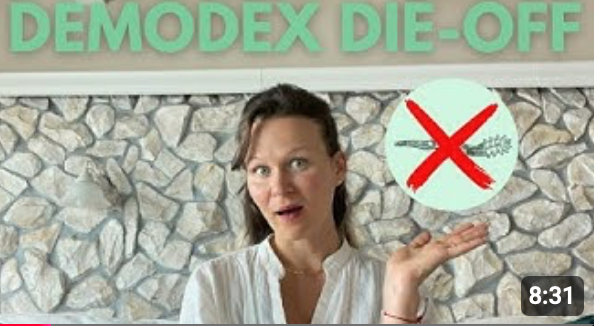 Demodex die-off symptoms